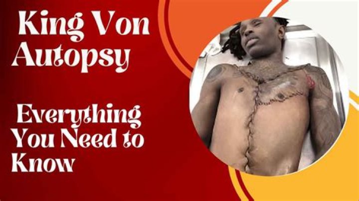 Shocking Revelation: Autopsy Photos Of King Von Unveiled